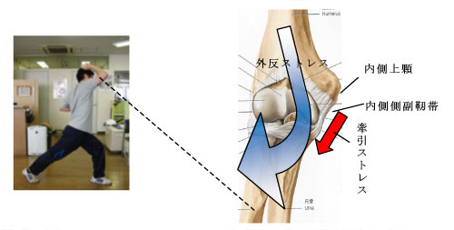 野球肘 西早稲田整形外科 公式 新宿区西早稲田 整形外科 リハビリテーション科 スポーツ整形外科